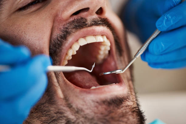Best Tooth Extraction  in Vega, TX
