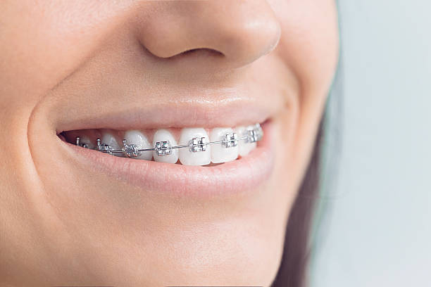 Best Full Mouth Reconstruction  in Vega, TX